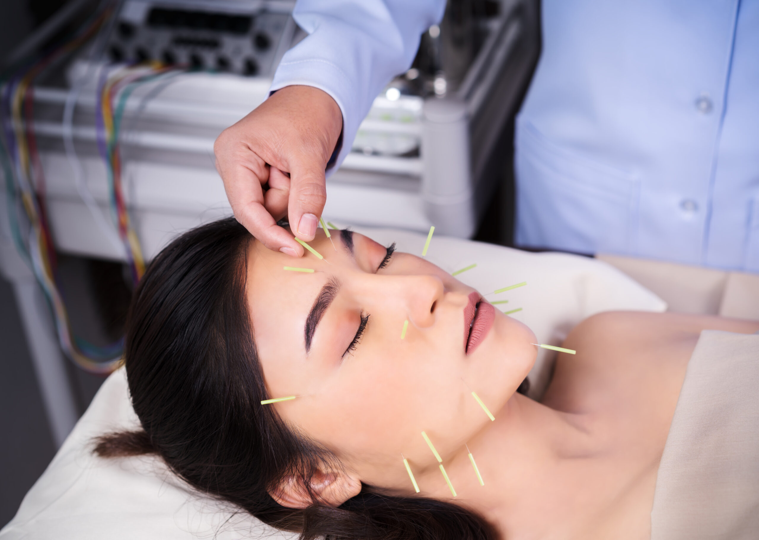 Thread Lift Treatment