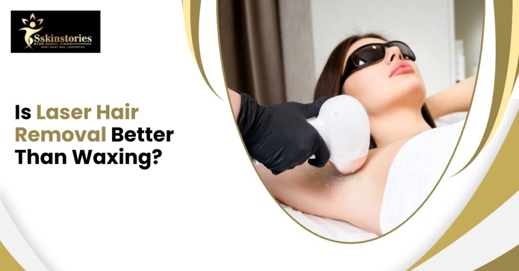 Laser Hair Removal